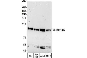 anti-Kinesin Family Member 18A (KIF18A) (C-Term) antibody
