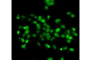 Immunofluorescence analysis of A-549 cells using WBSCR22 antibody (ABIN6132946, ABIN6150175, ABIN6150176 and ABIN6223157). (WBSCR22 anticorps  (AA 1-281))