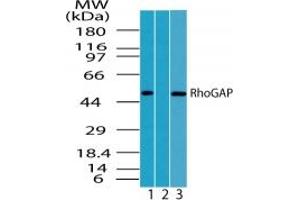 Image no. 1 for anti-rho GTPase Activating Protein 1 (ARHGAP1) (AA 1-50) antibody (ABIN207682) (ARHGAP1 anticorps  (AA 1-50))