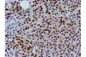 Image no. 5 for anti-Fragile X Mental Retardation 1 (FMR1) antibody (ABIN1498287)