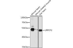 Western blot analysis of extracts of various cell lines, using LRRFIP2 Rabbit pAb (ABIN7268214) at 1:1000 dilution. (LRRFIP2 anticorps  (AA 150-340))