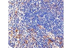 Immunohistochemical analysis of paraffin-embedded mouse spleen section using Lyn antibody (LYN anticorps  (AA 229-263))