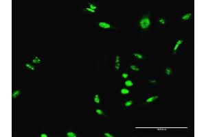 Immunofluorescence of purified MaxPab antibody to SCML1 on HeLa cell.