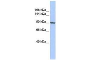 Image no. 1 for anti-TNNI3 Interacting Kinase (TNNI3K) (AA 755-804) antibody (ABIN6741016) (TNNI3K anticorps  (AA 755-804))