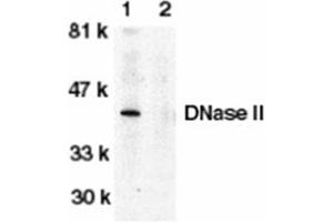 Image no. 1 for anti-Deoxyribonuclease II, Lysosomal (DNASE2) (C-Term) antibody (ABIN318974) (DNASE2 anticorps  (C-Term))