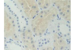 DAB staining on IHC-P; Samples: Human Kidney Tissue (AHCY anticorps  (AA 2-432))