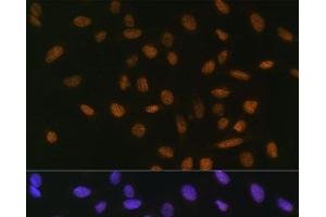 Immunofluorescence analysis of U-2 OS cells using Snail Polyclonal Antibody at dilution of 1:100.