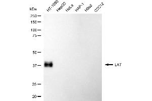Western blotting analysis using LAT antibody (ABIN7799272).