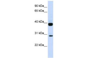 Flt3 Ligand antibody used at 1 ug/ml to detect target protein. (FLT3LG anticorps  (N-Term))