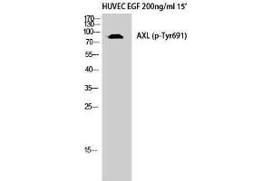 Western Blotting (WB) image for anti-AXL Receptor tyrosine Kinase (AXL) (pTyr691) antibody (ABIN3179699) (AXL anticorps  (pTyr691))