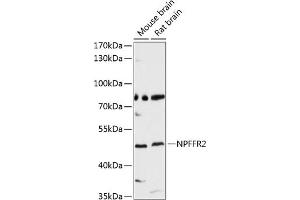 Western blot analysis of extracts of various cell lines, using NPFFR2 antibody (ABIN6128377, ABIN6144766, ABIN6144767 and ABIN6214924) at 1:3000 dilution. (NPFFR2 anticorps  (AA 1-140))