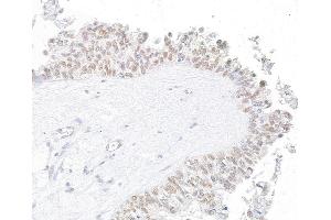 Immunohistochemistry (IHC) image for anti-Werner Helicase Interacting Protein 1 (WRNIP1) (AA 400-450) antibody (ABIN7454746)