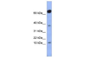 WB Suggested Anti-NKX6-3 Antibody Titration:  0. (NK6 Homeobox 3 anticorps  (Middle Region))