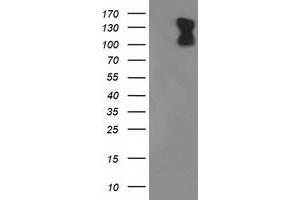 Western Blotting (WB) image for anti-phosphodiesterase 2A, CGMP-Stimulated (PDE2A) antibody (ABIN1500084) (PDE2A anticorps)
