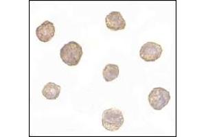 Immunohistochemistry (IHC) image for anti-BCL2-Like 11 (Apoptosis Facilitator) (BCL2L11) (AA 2-198) antibody (ABIN492532)