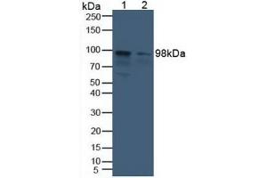 Western blot analysis of (1) Human Liver Tissue and (2) Human HeLa cells. (Aconitase 1 anticorps  (AA 251-443))