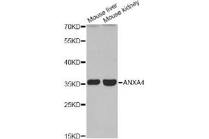 Western blot analysis of extracts of various cell lines, using ANXA4 antibody (ABIN6290015) at 1:1000 dilution. (Annexin IV anticorps)