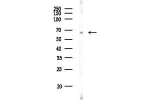 anti-Solute Carrier Family 13 Member 3 (SLC13A3) antibody