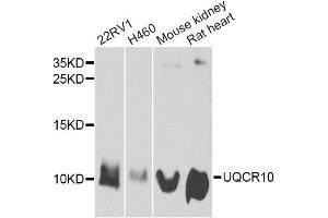 Western blot analysis of extracts of various cell lines, using UQCR10 antibody. (UQCR10 anticorps)