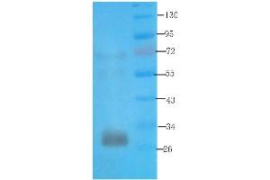 Western Blot using anti-syntaxin antibody ABIN7072248 Rat kidney lysate was resolved on a 12 % SDS PAGE gel and blots probed with ABIN7072248 at 3 μg/mL before being detected by a secondary antibody.