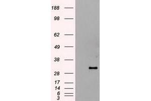 HEK293T cells were transfected with the pCMV6-ENTRY control (Left lane) or pCMV6-ENTRY HHex (RC204815) (Right lane) cDNA for 48 hrs and lysed. (HHEX anticorps  (AA 100-270))
