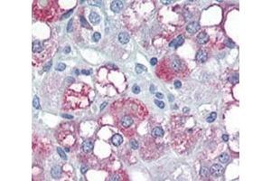 IHC analysis of FFPE human adrenal tissue stained with PDK4 antibody