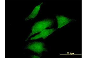 Immunofluorescence of purified MaxPab antibody to DGKA on HeLa cell.