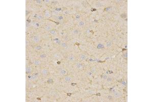 Immunohistochemistry of paraffin-embedded rat brain using HSD17B2 antibody at dilution of 1:200 (x400 lens).
