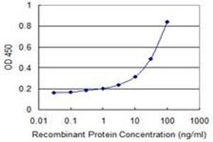 anti-Trinucleotide Repeat Containing 6B (TNRC6B) (AA 153-252) antibody
