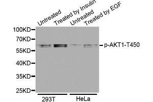 Western Blotting (WB) image for anti-V-Akt Murine Thymoma Viral Oncogene Homolog 1 (AKT1) (pThr450) antibody (ABIN1869963) (AKT1 anticorps  (pThr450))