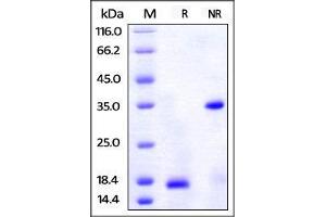 Human PDGF-BB, His Tag on SDS-PAGE under reducing (R) and no-reducing (NR) conditions.