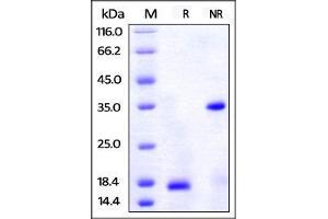 Human PDGF-BB, His Tag on SDS-PAGE under reducing (R) and no-reducing (NR) conditions. (PDGFB Protein (AA 82-190) (His tag,AVI tag))