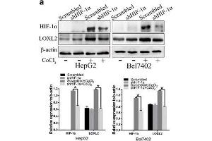 HIF-1α promotes LOXL2 expression was demonstrated by downregulation of HIF-1α with CoCl2 treatment in HepG2 and Bel7402 cells.