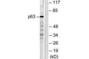 Western blot analysis of extracts from COS7 cells, using p63 antibody. (p63 anticorps)