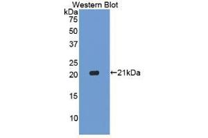 Western blot analysis of the recombinant protein. (Caspase 1 anticorps  (AA 120-297))