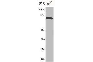 Western Blot analysis of HeLa cells using Phospho-p73 (Y99) Polyclonal Antibody (Tumor Protein p73 anticorps  (pTyr99))