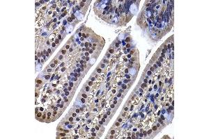 Immunohistochemistry of paraffin-embedded mouse ileum using DNAJB6 antibody.
