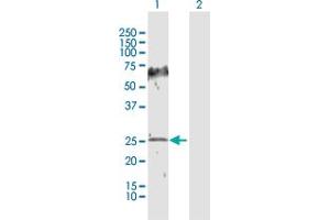 Western Blot analysis of HPGD expression in transfected 293T cell line by HPGD MaxPab polyclonal antibody.