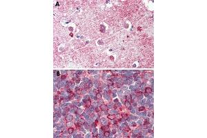 Immunohistochemical staining of formalin-fixed, paraffin-embedded human tonsil tissue after heat-induced antigen retrieval. (GPR26 anticorps  (Internal Region))