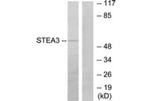 Western blot analysis of extracts from COLO205 cells, using STEA3 Antibody. (STEAP3 anticorps  (AA 421-470))