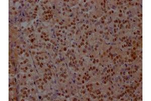 IHC image of ABIN7127582 diluted at 1:100 and staining in paraffin-embedded human adrenal gland tissue performed on a Leica BondTM system.