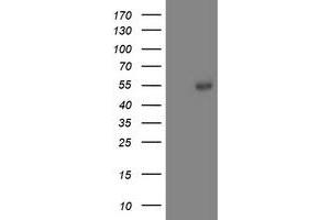 Western Blotting (WB) image for anti-Aminoacylase 1 (ACY1) antibody (ABIN1496456) (Aminoacylase 1 anticorps)