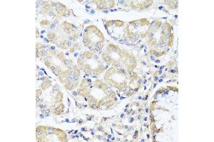 Immunohistochemistry of paraffin-embedded human gastric using OPA3 antibody at dilution of 1:100 (x40 lens). (OPA3 anticorps)