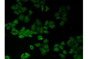 Detection of CD147 in Human Hela Cells using Polyclonal Antibody to Cluster Of Differentiation 147 (CD147)