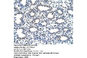Rabbit Anti-SMARCD2 Antibody  Paraffin Embedded Tissue: Human Lung Cellular Data: Alveolar cells Antibody Concentration: 16 ug/ml Magnification: 400X (SMARCD2 anticorps  (C-Term))