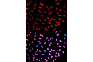 Immunofluorescence (IF) image for anti-Extra Spindle Poles Like 1 (ESPL1) (pSer1126) antibody (ABIN1876756) (Separase anticorps  (pSer1126))