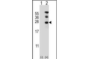 Western blot analysis of RAN (arrow) using rabbit polyclonal RAN Antibody (N-term) (ABIN390647 and ABIN2840945).