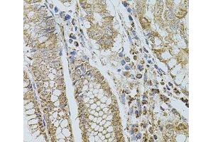 Immunohistochemistry of paraffin-embedded Human stomach using SELP Polyclonal Antibody at dilution of 1:100 (40x lens). (P-Selectin anticorps)
