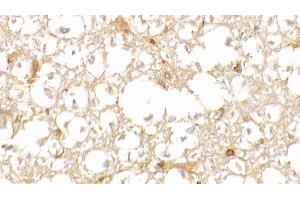 Detection of HbA1c in Human Spinal cord Tissue using Polyclonal Antibody to Glycated Hemoglobin A1c (HbA1c)