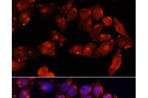 Immunofluorescence analysis of HeLa cells using ACVR2B Polyclonal Antibody at dilution of 1:100 (40x lens). (ACVR2B anticorps)